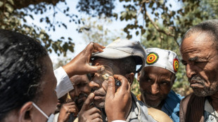 'I rip out my lashes to ease pain': Eye disease afflicts Ethiopia