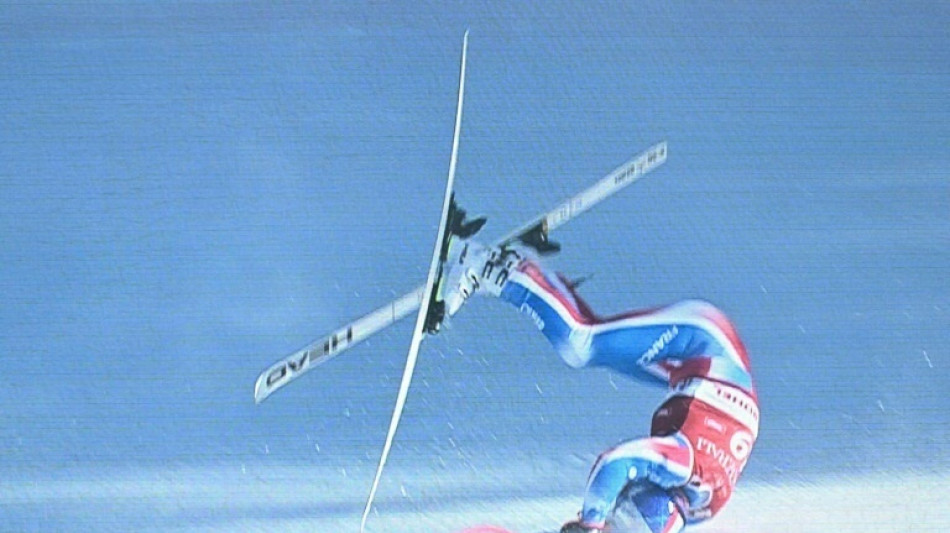 French skier Pinturault's season over with broken leg